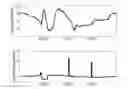 Fig. 01 - MEDICAL ARRANGEMENTS AND A METHOD FOR DETERMINING PARAMETERS RELATED TO INSULIN THERAPY, PREDICTING GLUCOSE VALUES AND FOR PROVIDING INSULIN DOSING RECOMMENDATIONS