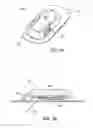Fig. 02 - TRANSCUTANEOUS MEDICAL DEVICE WITH VARIABLE STIFFNESS