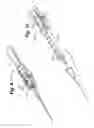Fig. 06 - Needle assembly with diagnostic analysis provisions
