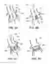 Fig. 12 - LUMINAL ORGAN SIZING DEVICES AND METHODS