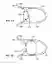 Fig. 18 - LUMINAL ORGAN SIZING DEVICES AND METHODS