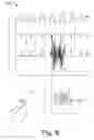 Fig. 07 - Altering Physiological Signals Based On Patient Movement