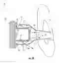 Fig. 04 - WEARABLE DEVICE HAVING A BAND WITH SENSOR ELEMENTS