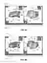 Fig. 09 - Electroanatomical mapping tools facilitated by activation waveforms