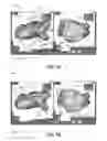 Fig. 11 - Electroanatomical mapping tools facilitated by activation waveforms