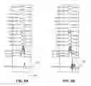 Fig. 13 - Electroanatomical mapping tools facilitated by activation waveforms