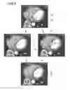 Fig. 03 - Medical image processing apparatus and X-ray CT apparatus