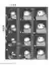 Fig. 04 - Medical image processing apparatus and X-ray CT apparatus