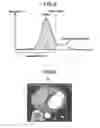 Fig. 05 - Medical image processing apparatus and X-ray CT apparatus