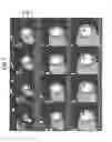 Fig. 06 - Medical image processing apparatus and X-ray CT apparatus