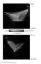 Fig. 14 - Rapid 3D cardiac parameter mapping