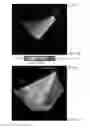Fig. 15 - Rapid 3D cardiac parameter mapping