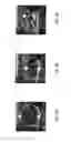 Fig. 09 - Non-invasive assessment of anatomic vessels