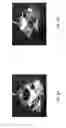 Fig. 12 - Non-invasive assessment of anatomic vessels