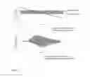 Fig. 02 - Apparatus And Method For Non-Invasive Determination Of Intracranial Pressure