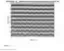 Fig. 05 - Apparatus And Method For Non-Invasive Determination Of Intracranial Pressure