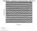 Fig. 09 - Apparatus And Method For Non-Invasive Determination Of Intracranial Pressure