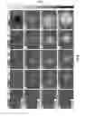 Fig. 08 - Methods, systems and computer program products for single track location shear wave elasticity imaging