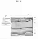 Fig. 09 - APPARATUS AND METHOD FOR VISUALIZING ANATOMICAL ELEMENTS IN A MEDICAL IMAGE