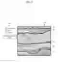 Fig. 10 - APPARATUS AND METHOD FOR VISUALIZING ANATOMICAL ELEMENTS IN A MEDICAL IMAGE