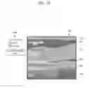Fig. 11 - APPARATUS AND METHOD FOR VISUALIZING ANATOMICAL ELEMENTS IN A MEDICAL IMAGE
