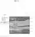 Fig. 12 - APPARATUS AND METHOD FOR VISUALIZING ANATOMICAL ELEMENTS IN A MEDICAL IMAGE