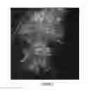 Fig. 03 - METHOD AND DEVICE FOR COLLECTING MYCOBACTERIUM COMPLEX SPECIES FROM TEH ORAL CAVITY OF A PATIENT