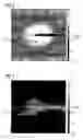 Fig. 03 - Biopsy needle for biopsy sampling, biopsy device, and methods of manufacturing a biopsy needle or a biopsy device