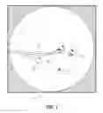 Fig. 02 - Computed tomography enhanced fluoroscopic system, device, and method of utilizing the same