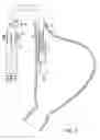 Fig. 14 - METHODS AND DEVICES FOR MANIPULATING AND FASTENING TISSUE