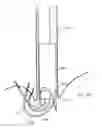 Fig. 35 - METHODS AND DEVICES FOR MANIPULATING AND FASTENING TISSUE