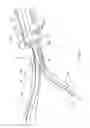 Fig. 06 - Specimen retrieval device
