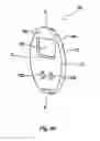 Fig. 13 - Specimen retrieval device