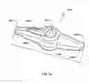 Fig. 18 - Specimen retrieval device