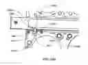 Fig. 32 - Specimen retrieval device