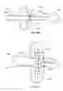 Fig. 44 - Specimen retrieval device