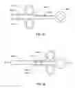 Fig. 45 - Specimen retrieval device