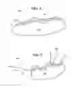 Fig. 03 - SELF-PUNCHING SOFT ANCHOR