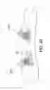 Fig. 18 - SELF-PUNCHING SOFT ANCHOR