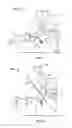 Fig. 07 - Shape memory filament for suture management