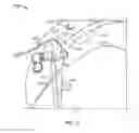Fig. 09 - Shape memory filament for suture management