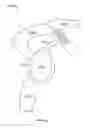 Fig. 10 - Shape memory filament for suture management