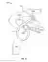 Fig. 14 - Shape memory filament for suture management