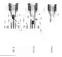 Fig. 10 - Delivery system for micrograft for treating intracranial aneurysms