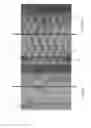 Fig. 21 - Delivery system for micrograft for treating intracranial aneurysms