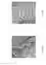 Fig. 22 - Delivery system for micrograft for treating intracranial aneurysms