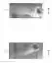 Fig. 24 - Delivery system for micrograft for treating intracranial aneurysms