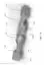 Fig. 33 - Delivery system for micrograft for treating intracranial aneurysms