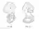 Fig. 03 - Intramedullary fixation system for management of pelvic and acetabular fractures