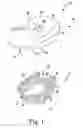 Fig. 02 - Method and orthopaedic surgical instrument system for surgically preparing a patient's bone